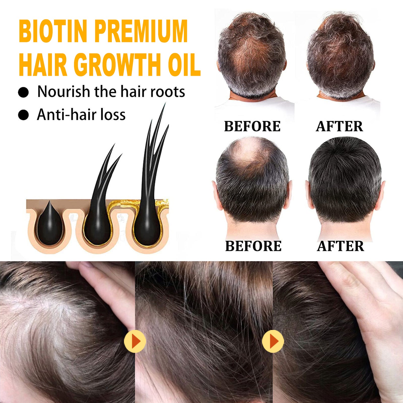 Glowify EELHOE Biotin Hair Treatment Oil – Moisturizing Scalp Massage Oil for Thick, Smooth Hair - Glowify