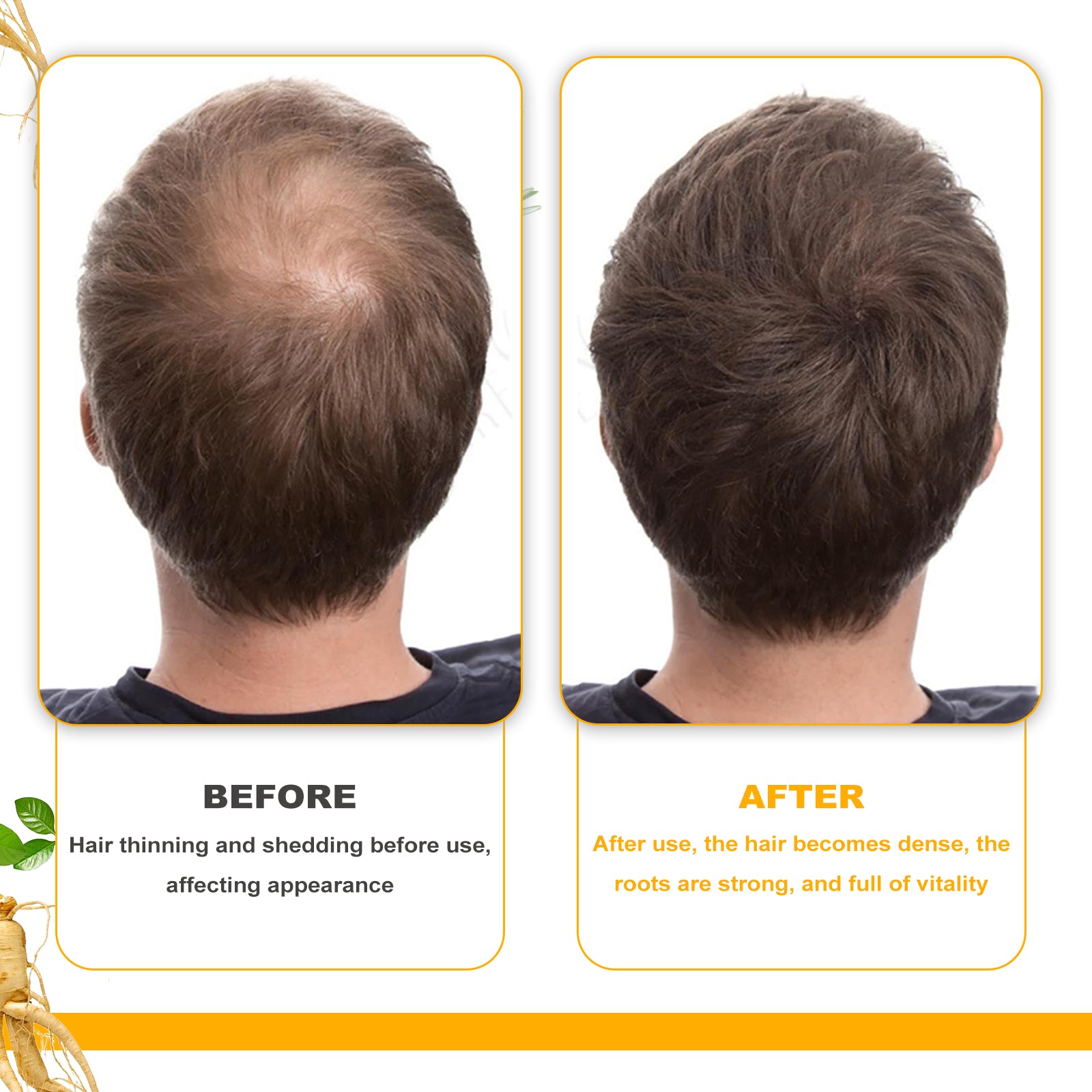 Glowify EELHOE Biotin Hair Treatment Oil – Moisturizing Scalp Massage Oil for Thick, Smooth Hair - Glowify